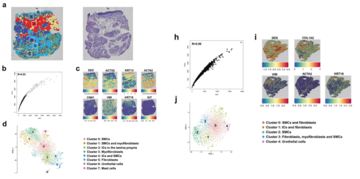 Figure_2._IC_and_Control_Bladder_Spatial_Transcriptome_Atlas.png