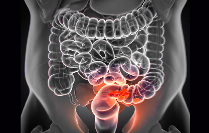 Targeted Medication Guidance for Colorectal Cancer