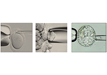 Preimplantation Embryo Genetic Screening (PGS)