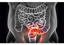 Individualized Medication Guidance for Gastrointestinal Cancer