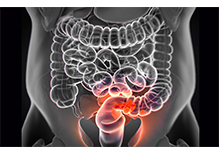 Targeted Medication Guidance for Colorectal Cancer