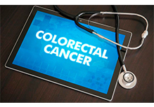 The Disease Susceptibility Genetic Test-Colorectal Cancer